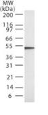 Anti-Caspase 2 antibody [18E809.3] used in Western Blot (WB). GTX13870