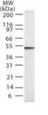 Anti-Caspase 2 antibody [18E809.3] used in Western Blot (WB). GTX13870
