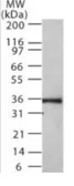Anti-NIFK antibody [18E148] used in Western Blot (WB). GTX13880