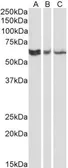 Anti-RAP1 antibody [78B356.1] used in Western Blot (WB). GTX13889