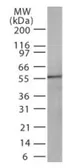 Anti-DR4 antibody [32A242] used in Western Blot (WB). GTX13890
