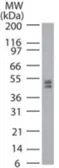 Anti-DNMT2 antibody used in Western Blot (WB). GTX13892