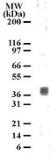 Anti-5-HT1B receptor antibody used in Western Blot (WB). GTX13896