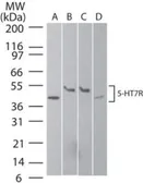 Anti-5-HT7 receptor antibody used in Western Blot (WB). GTX13898