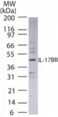 Anti-IL17 Receptor beta antibody used in Western Blot (WB). GTX13908