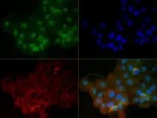 Anti-Lamin A + C antibody used in Immunocytochemistry/ Immunofluorescence (ICC/IF). GTX13910