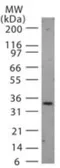 Anti-NIFK antibody used in Western Blot (WB). GTX13912