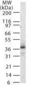 Anti-CXCR1 antibody used in Western Blot (WB). GTX13920
