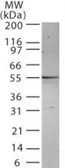 Anti-Presenilin 2 antibody [198C679.2.1] used in Western Blot (WB). GTX13926