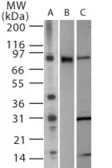 Anti-TLR2 antibody used in Western Blot (WB). GTX13930