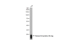 Human IL5 protein, His tag. GTX139317-pro