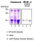 Anti-CENPA antibody [3-19] used in Western Blot (WB). GTX13939