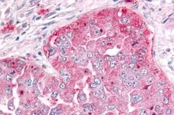 Anti-ADAMTS5 antibody used in IHC (Paraffin sections) (IHC-P). GTX13976