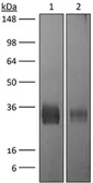 Anti-CTLA4 antibody [UC10-4F10-11] used in Western Blot (WB). GTX13996