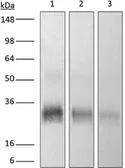 Anti-CTLA4 antibody [9H10] used in Western Blot (WB). GTX14005