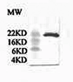 Anti-C Reactive Protein antibody used in Western Blot (WB). GTX14008