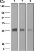 Anti-CD8 alpha antibody [2.43] used in Western Blot (WB). GTX14075