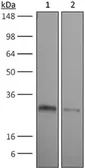 Anti-CD90.2 antibody [30H12] used in Western Blot (WB). GTX14089