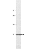 Anti-14-3-3 sigma antibody [1.T.28] used in Western Blot (WB). GTX14122