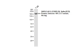 SARS-CoV-2 (COVID-19) Spike (ECD) Protein, Omicron / KP.3.1.1  variant, His tag. GTX141253-pro