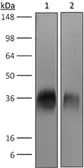 Anti-CTLA4 antibody [9D9] used in Western Blot (WB). GTX14132