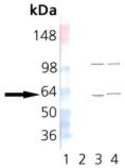 Anti-TCP1 alpha antibody [4E215] used in Western Blot (WB). GTX14136