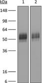 Anti-PD-L1 antibody [10F.9G2] used in Western Blot (WB). GTX14145