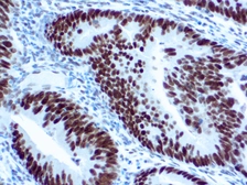 Anti-MLH1 antibody [G168-15] used in IHC (Paraffin sections) (IHC-P). GTX14206
