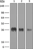Anti-CD8 antibody [YTS 169.4] used in Western Blot (WB). GTX14216