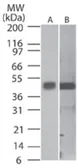 Anti-Caspase 1 antibody [14F468] used in Western Blot (WB). GTX14367