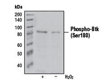 Anti-BTK (phospho Ser180) antibody [3i5(3D3)] used in Western Blot (WB). GTX14393