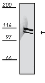 Anti-Dynamin 1 antibody [4E67] used in Western Blot (WB). GTX14448