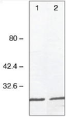 Anti-Galectin 4 antibody [3G152] used in Western Blot (WB). GTX14477