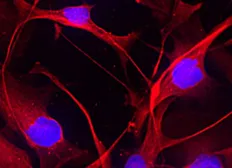 Anti-A2B5 antibody [105] used in Immunocytochemistry/ Immunofluorescence (ICC/IF). GTX14538