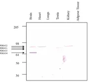 Anti-PDE1C antibody used in Western Blot (WB). GTX14602