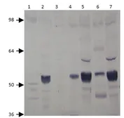 Anti-PDE7A antibody used in Western Blot (WB). GTX14616