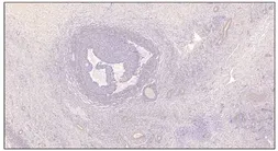 Anti-PDE7B antibody used in Immunohistochemistry (IHC). GTX14617