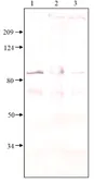 Anti-PDE8A antibody used in Western Blot (WB). GTX14619