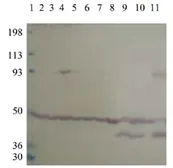 Anti-PDE10A antibody used in Western Blot (WB). GTX14622