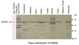 Anti-PDE9A antibody used in Western Blot (WB). GTX14625