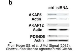 Anti-PDE4D5 antibody used in Western Blot (WB). GTX14626