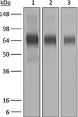 Anti-IFNAR1 antibody [MAR1-5A3] used in Western Blot (WB). GTX14637