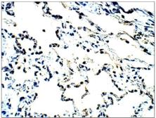 Anti-MUC1 antibody used in IHC (Paraffin sections) (IHC-P). GTX14690