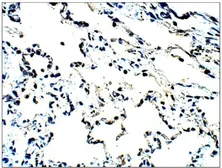 Anti-MUC1 antibody used in IHC (Paraffin sections) (IHC-P). GTX14690