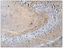 Anti-Synaptophysin antibody used in IHC (Paraffin sections) (IHC-P). GTX14692