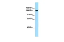 Anti-CD109 antibody, Internal used in Western Blot (WB). GTX14719
