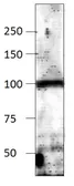 Anti-ADCY9 antibody used in Western Blot (WB). GTX14783