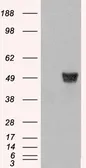 Anti-Coronin 1A antibody used in Western Blot (WB). GTX14787