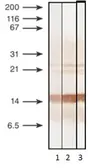 Anti-Procalcitonin antibody [6F10] used in Western Blot (WB). GTX14816