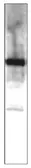 Anti-MERTK antibody used in Western Blot (WB). GTX14919